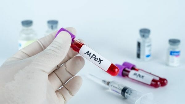 Mpox