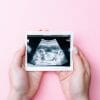 Pregnancy screening photo