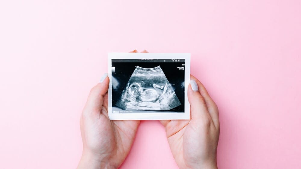 Pregnancy screening photo