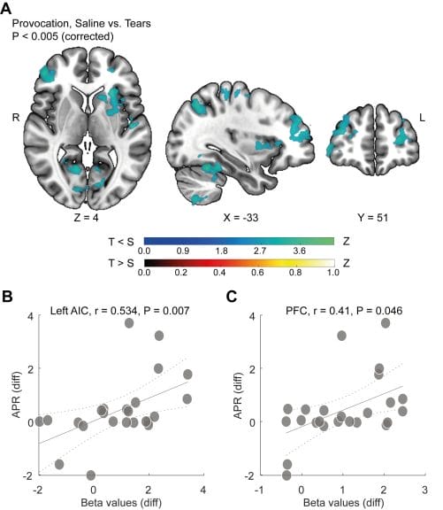 Chart demonstrating brain activity in male brains when smelling female tears, versus saline solution.