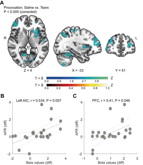 Chart demonstrating brain activity in male brains when smelling female tears, versus saline solution. 