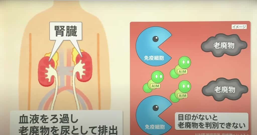 AIM Japanese Diagram