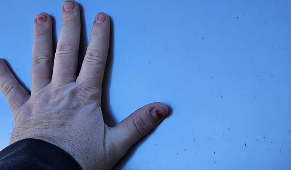 A man's hand placed flat on a steel surface with specks of rust on it