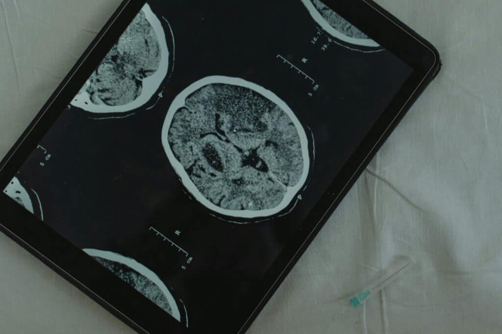 a photo of an iPad picturing cross-section photos of the brain