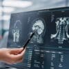 Brain research being conducted by neurologist