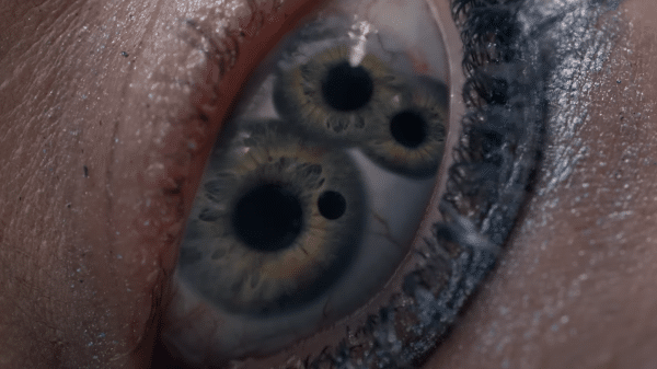 A close of a woman's (Elisabeth's) eye with three pupils