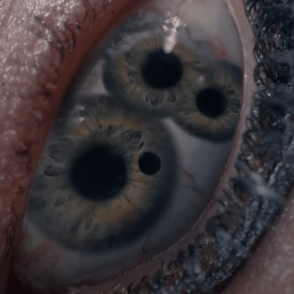 A close of a woman's (Elisabeth's) eye with three pupils