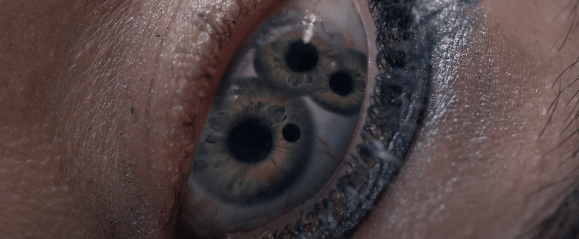 A close of a woman's (Elisabeth's) eye with three pupils