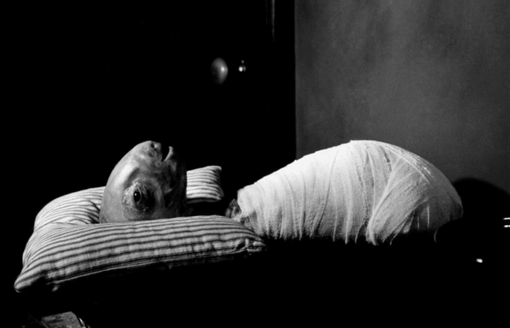 The "Eraserhead Baby," wrapped in white surgical wrappings, laying its inhuman head on a stripped pillow.