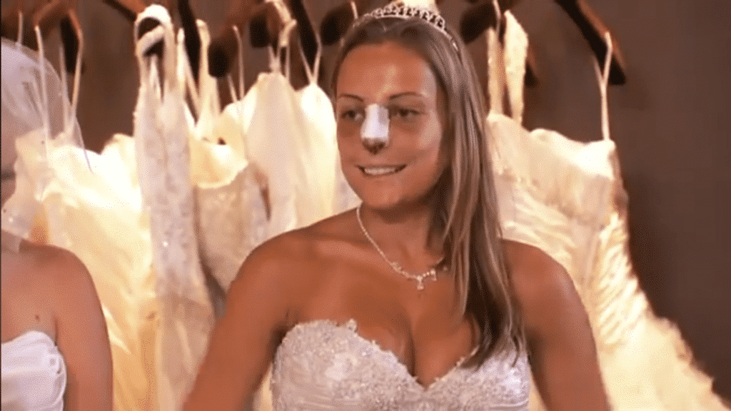 A screenshot from the first episode of Bridalplasty depicting a woman in a bride's dress with bandages over her nose.